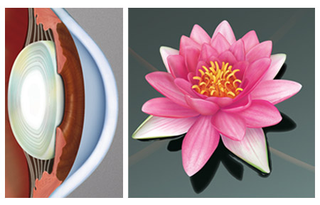 Eye Diagram and Waterlily