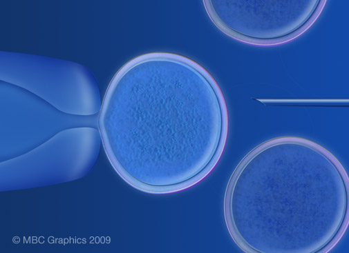 Illustration of Somatic Cell Nuclear Transfer Process